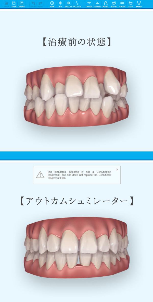 比較図